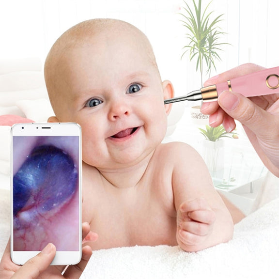 A2 WiFi Endoscope Camera 720P Ear Cleaning Wireless Safe Ear Pick Tool Visual Ear Spoon, Diameter: 4.4mm(Pink)