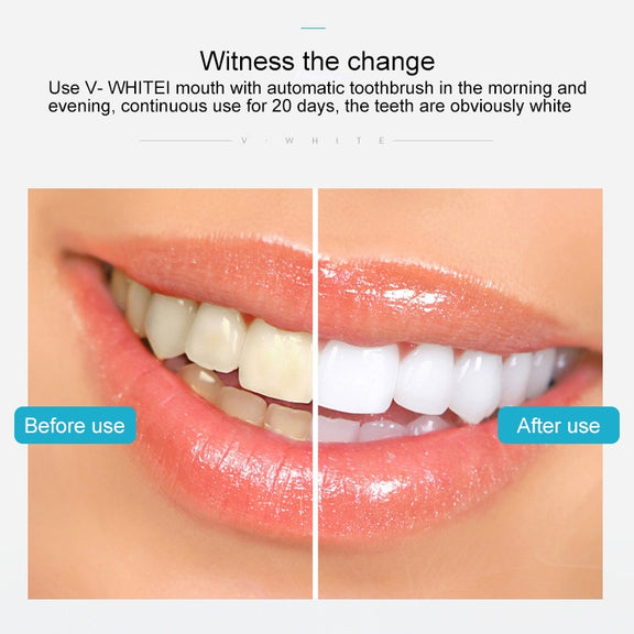 Vwhite 3 Cleaning Modes Silicone Electric Automatic Beauty Tooth Instrument(White)