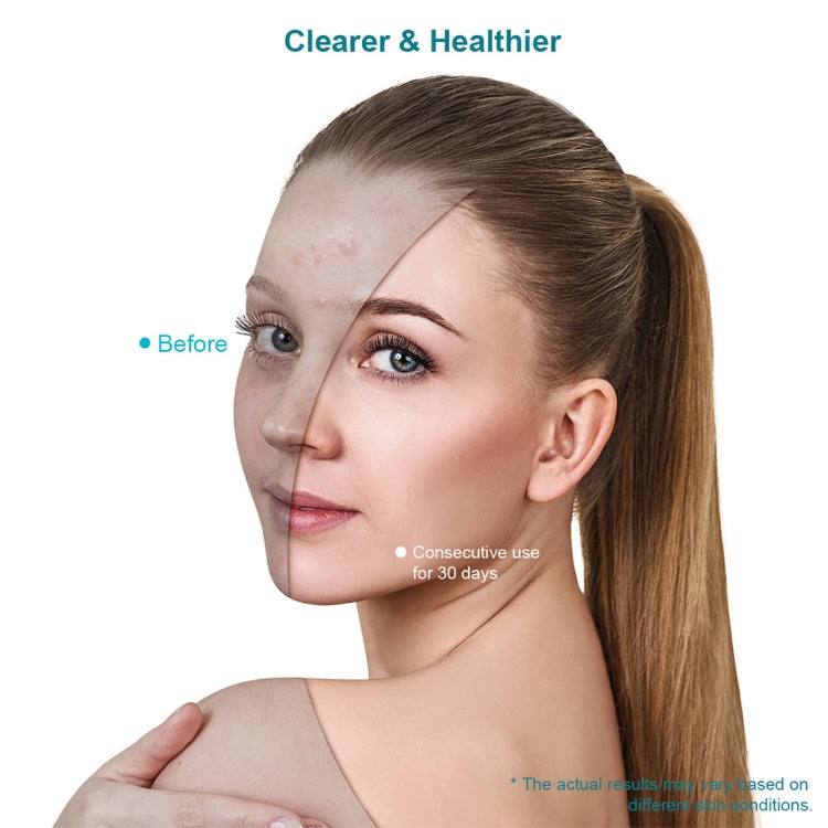 Xpreen  Blue & Red Light Therapy Acne Treatment Face Mask - free shipping - PMC Jewellery - Order now!