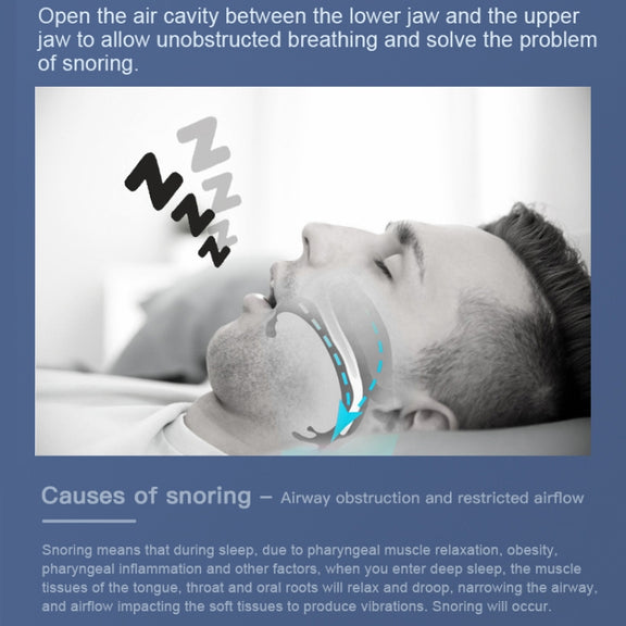 YJK100 Silicone + ABS Stop Snoring Device Anti Snore (White)