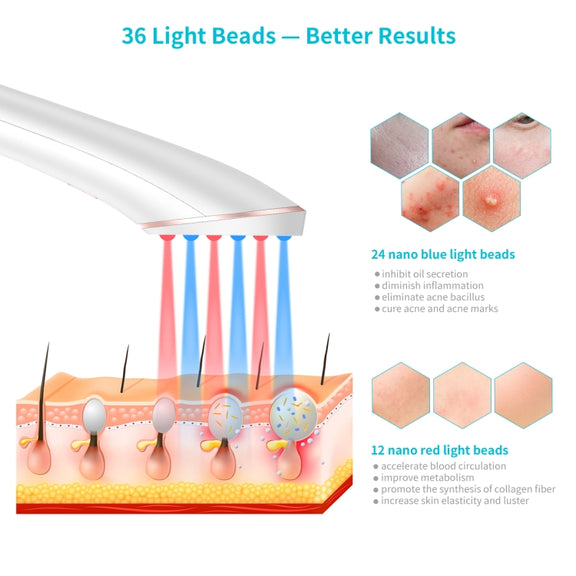 XPREEN XPRE052 Wireless Rechargeable Light Acne Treatment Device Home Acne Clearing Eraser with Blue Light and Red Light(White)