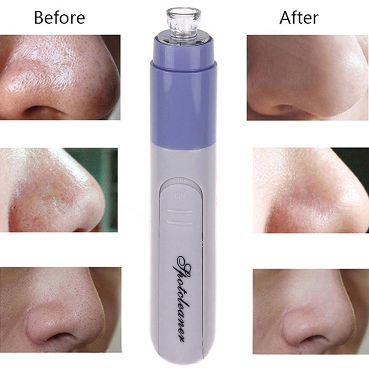 Facial Pore Cleanser Blackhead Vacuum Suction Remover(Pink) - Cleanser by PMC Jewellery | Online Shopping South Africa | PMC Jewellery | Buy Now Pay Later Mobicred