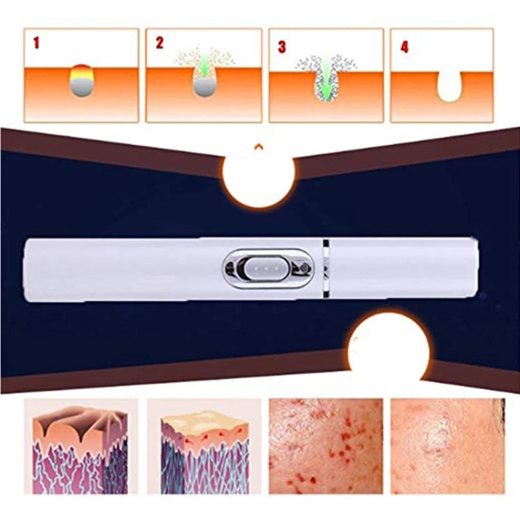 K-SKIN KD-7910 Acne Laser Pen Portable Wrinkle Removal Machine Durable Soft Scar Remover Device Blue Light Therapy Pen - free shipping - PMC Jewellery - Order now!