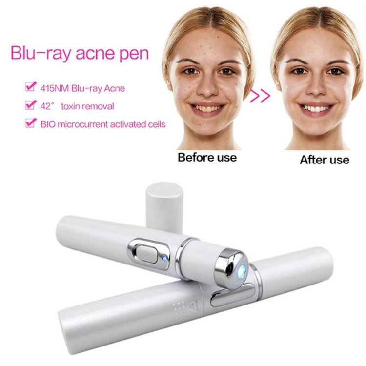 K-SKIN KD-7910 Acne Laser Pen Portable Wrinkle Removal Machine Durable Soft Scar Remover Device Blue Light Therapy Pen - free shipping - PMC Jewellery - Order now!