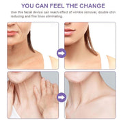 Electric Dolphin Neck Massager Wrinkle Removal Handheld Vibration Neck Face Massage Beauty Instrument Tool(Pearl White)