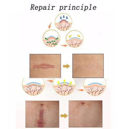 Organic silicone Gel Scar Therapy Patch  be Washed and Reused - free shipping - PMC Jewellery - Order now!
