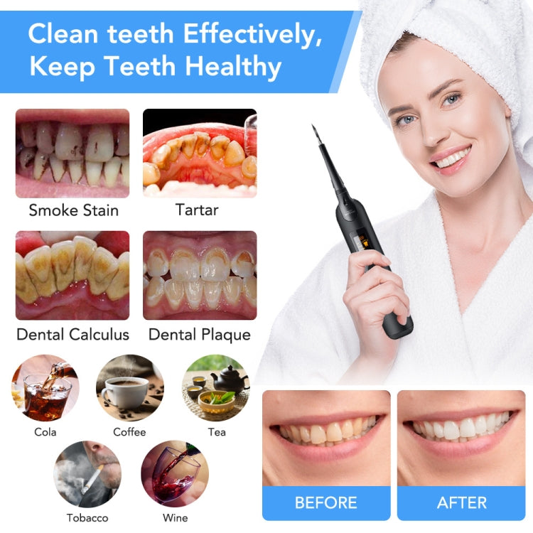 Dental Cleaning And Scaler Household Portable Electric Dental Care Tool Beauty Dental Instrument - Oral Irrigators by PMC TechLife | Online Shopping South Africa | PMC TechLife