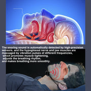 USB Rechargeable Smart Anti-snoring Device Home Snoring Corrector(Black)