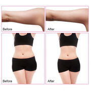 3-in-1 40K Ultrasonic Fat Blasting Device  Radio Frequency Beauty Device Plastic Handle(AU Plug)