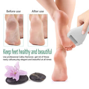 Electric Foot Grinder Digital Display USB Pedicure Peeling(Gold)
