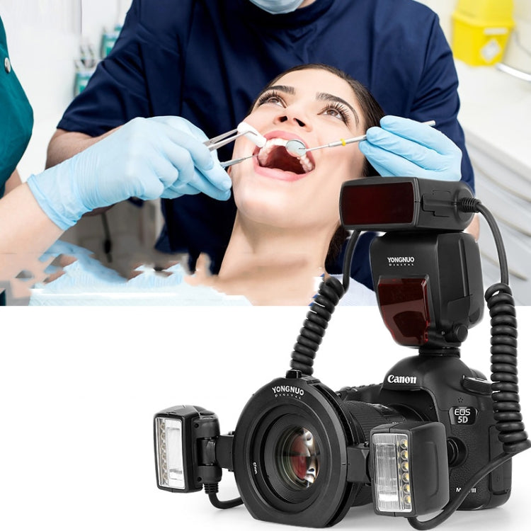 For Canon TTL Oral Insect Insect Teeth Ring Light YONGNUO YN24EX Macro Ring Flash Speedlite(Black) - free shipping - PMC Jewellery - Order now!