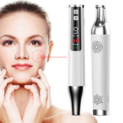 AA-A401 Small Freckle and Mole Removal Pen Tattoo and Eyebrow Removal Beauty Instrument, Color: Blu-ray Battery