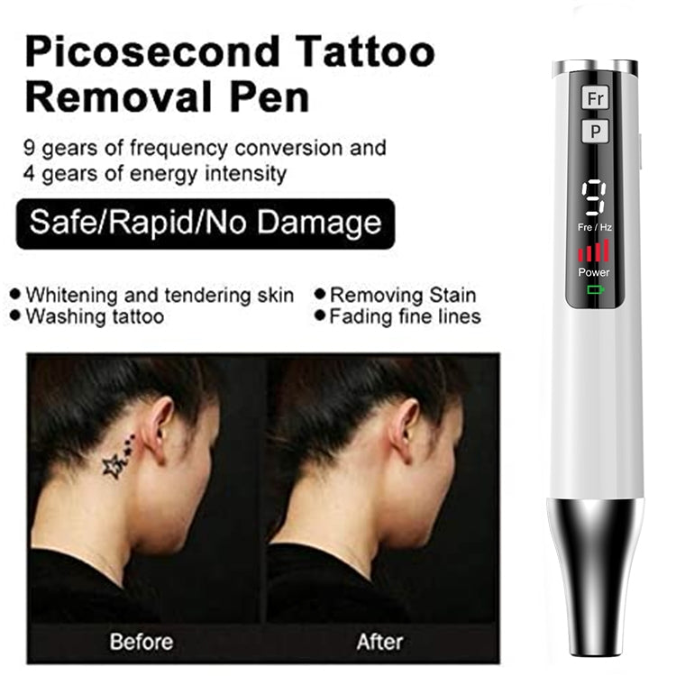 AA-A401 Small Freckle and Mole Removal Pen Tattoo and Eyebrow Removal Beauty Instrument, Color: Blu-ray Battery