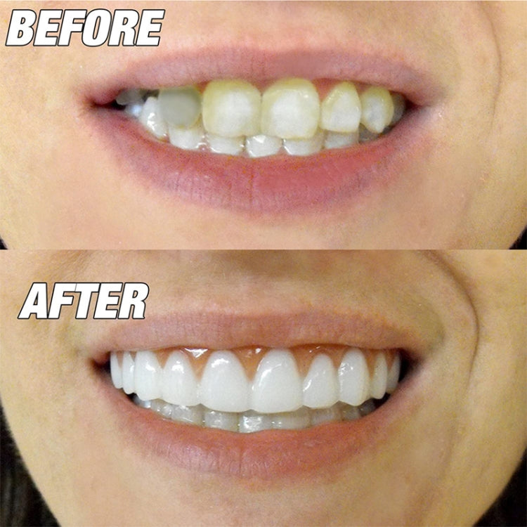 Beauty Tool False Teeth Instant Smile Comfort Fit Flex Fake Tooth Cover - free shipping - PMC Jewellery - Order now!